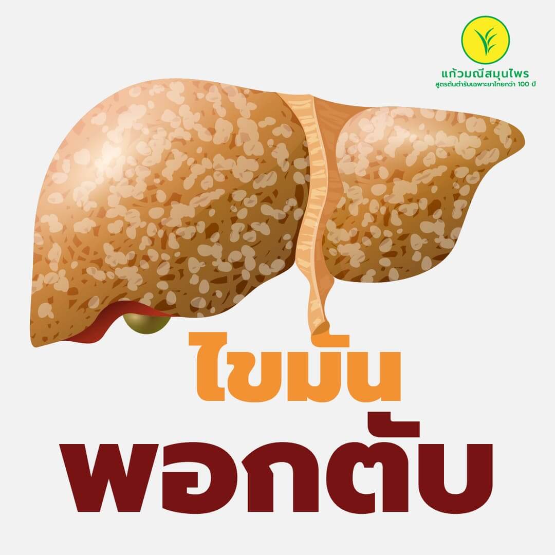 ไขมันพอกตับ (Fatty Liver Disease)