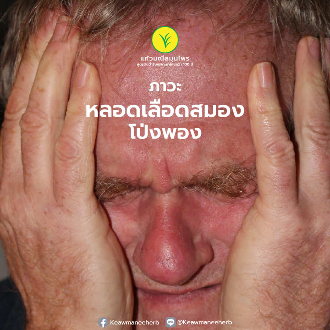 ภาวะหลอดเลือดสมองโป่งพอง (Cerebral Aneurysm)